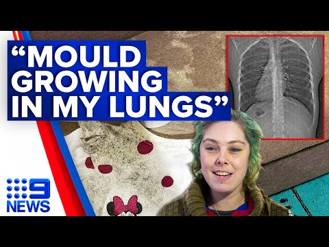 San-air Mould Gone Gel 75g-RV Online